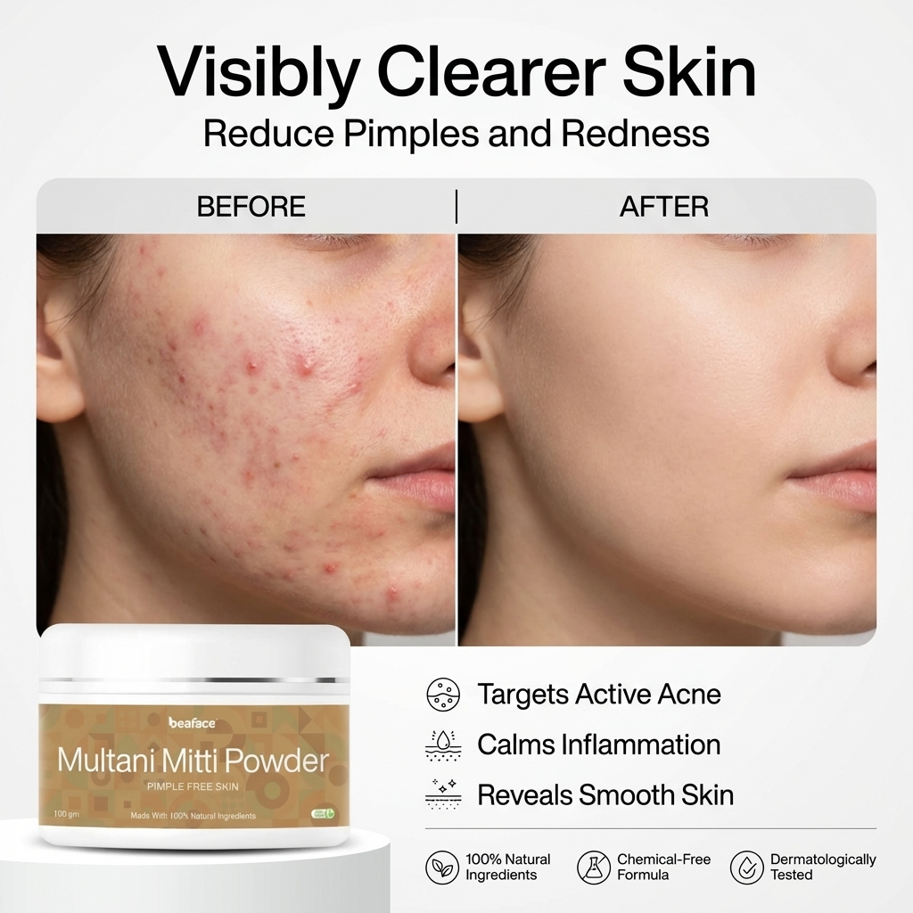 Multani Miti powder-acne-blemishes