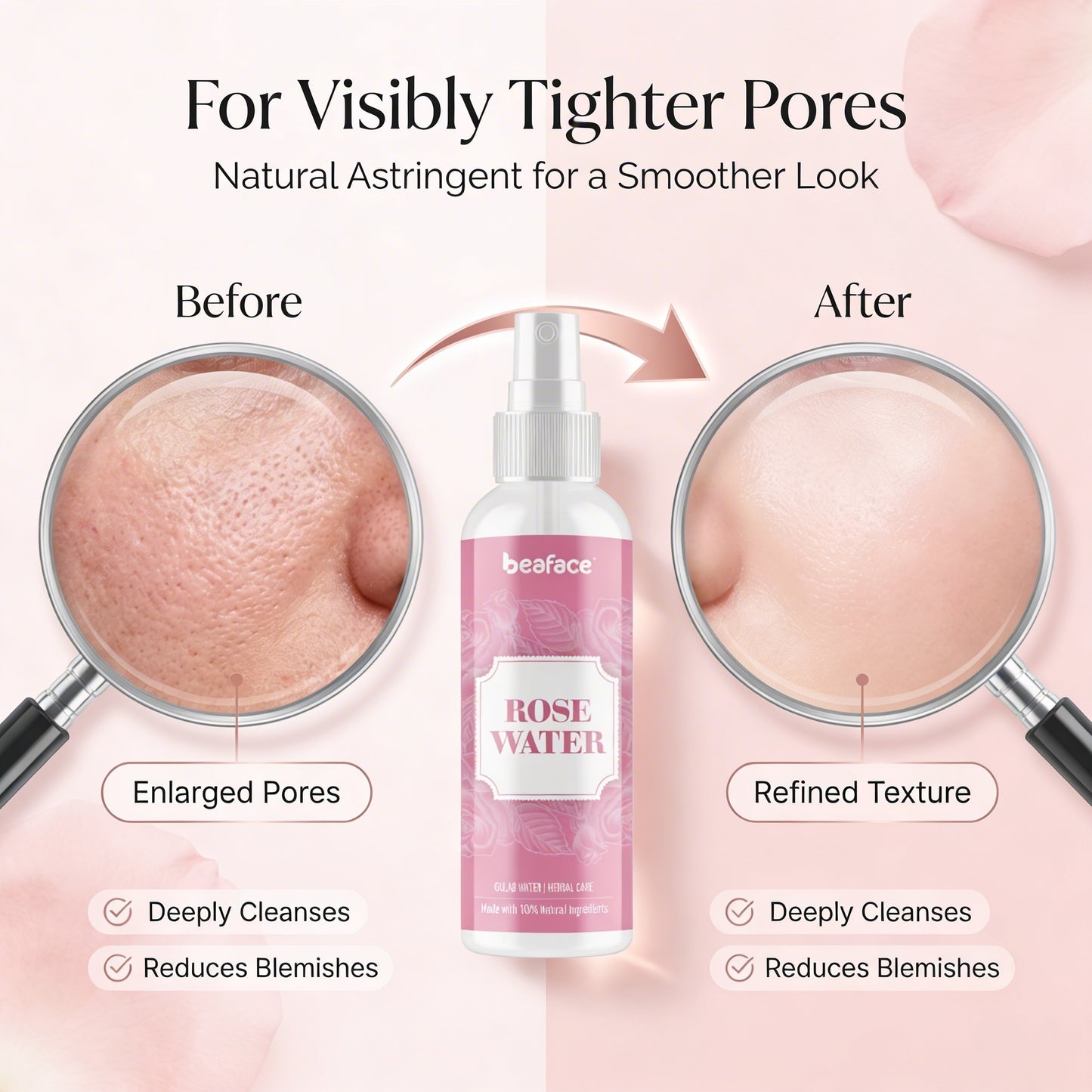 Rosewater-reduces-irritation-soothes-redness-hydration